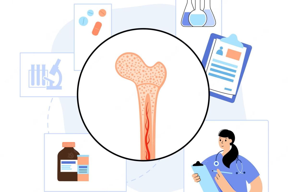 Bone Marrow Transplant Cost In India (Stem Cell Transplant)