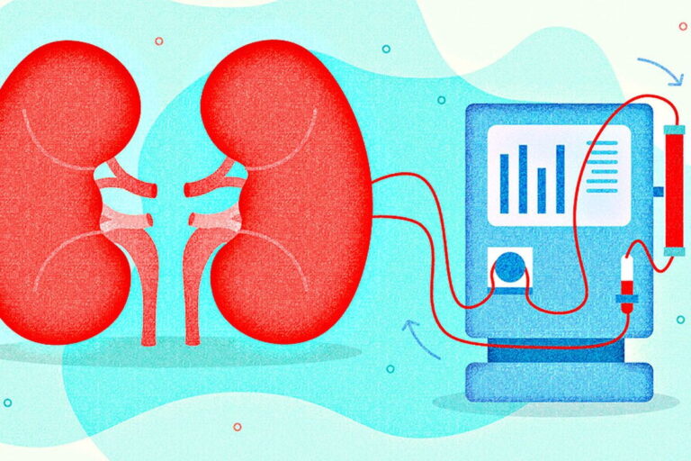 Learn Everything About Dialysis In India