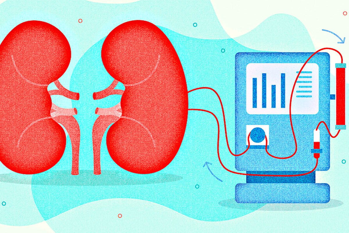 Dialysis Cost In India & Best Hospitals For Dialysis In India