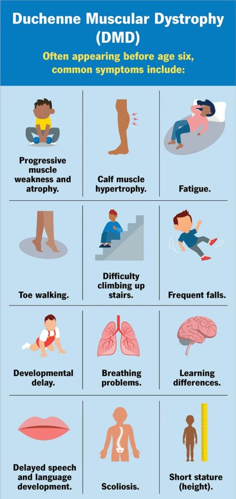 Duchenne Muscular Dystrophy - DMD Symptoms