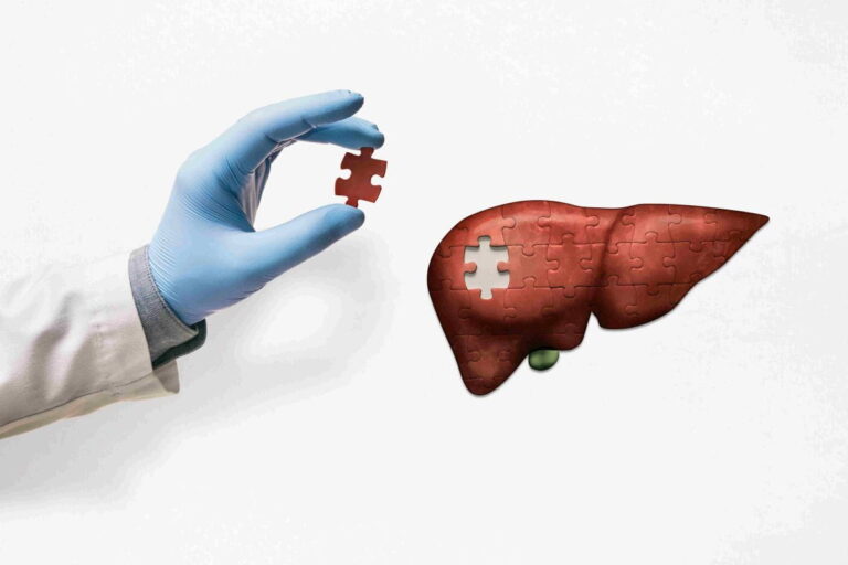 Liver Transplant Cost In Hyderabad