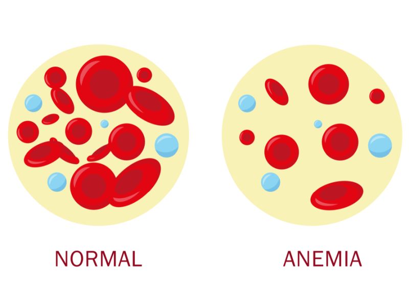 Low Red Blood Cell Count Cancer Symptoms