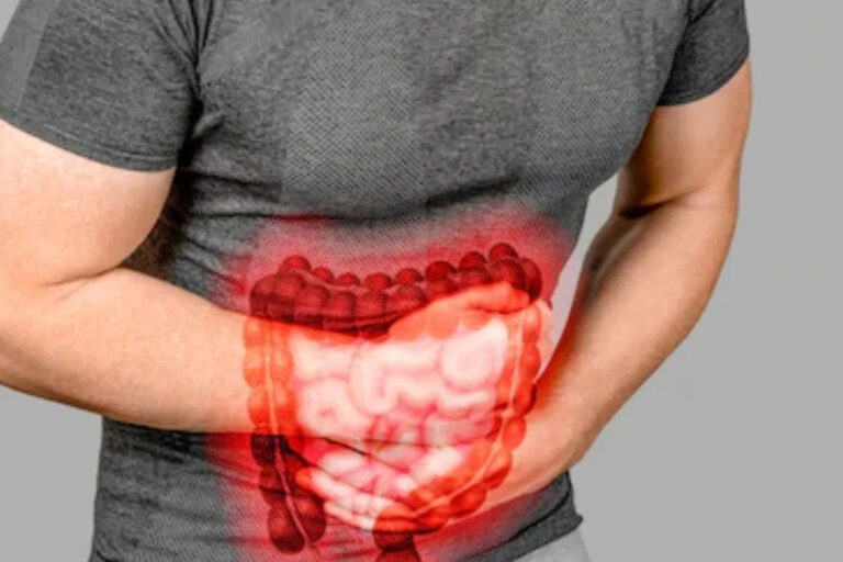 कोलन कैंसर के लक्षण