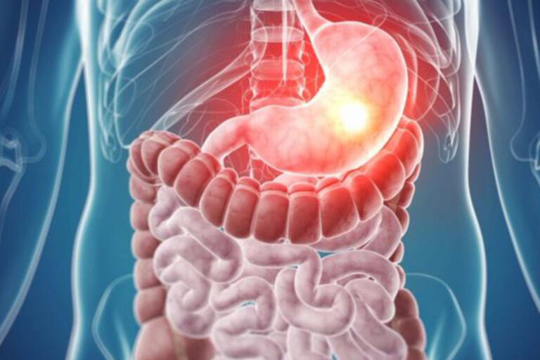 पेट के कैंसर के लक्षण
