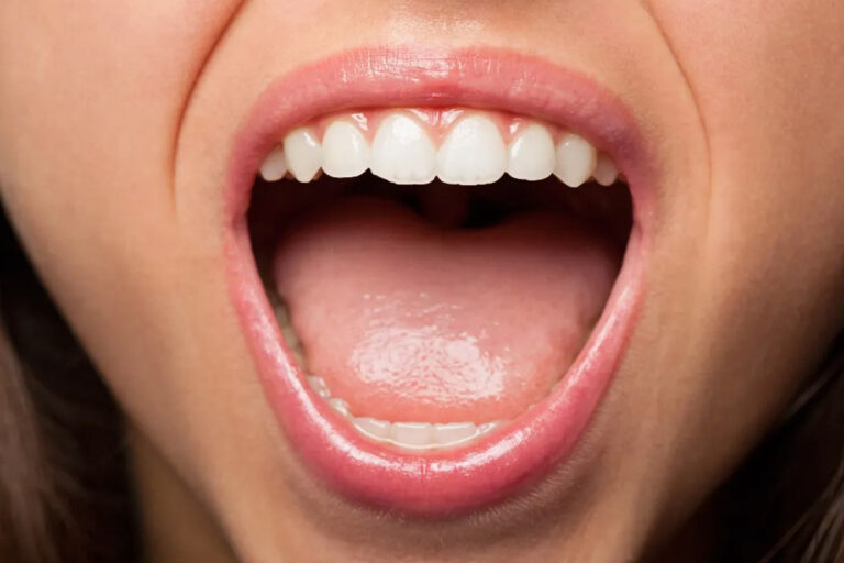 मुंह के कैंसर के लक्षण