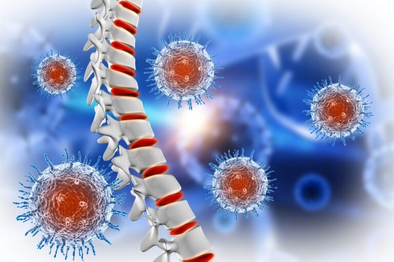 रीढ़ की हड्डी के कैंसर के लक्षण