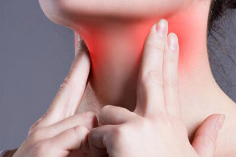 लिम्फ नोड कैंसर के लक्षण