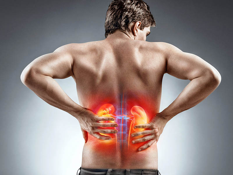 किडनी कैंसर के लक्षण