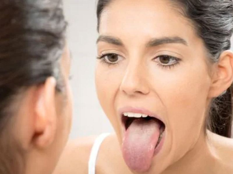 जीभ में कैंसर के लक्षण