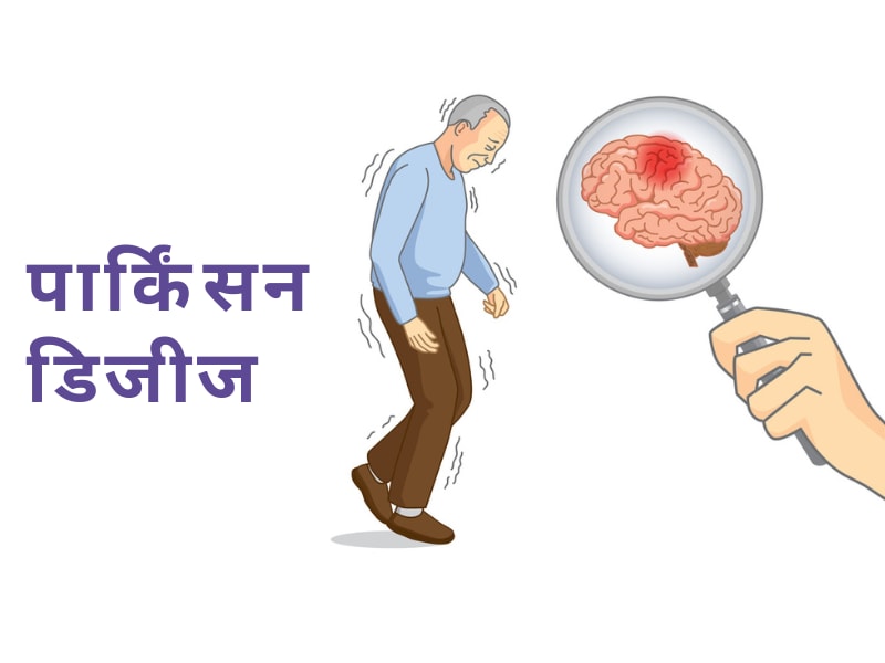 पार्किंसन डिजीज के लक्षण