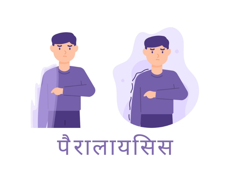 पैरालायसिस (लकवा) होने के लक्षण