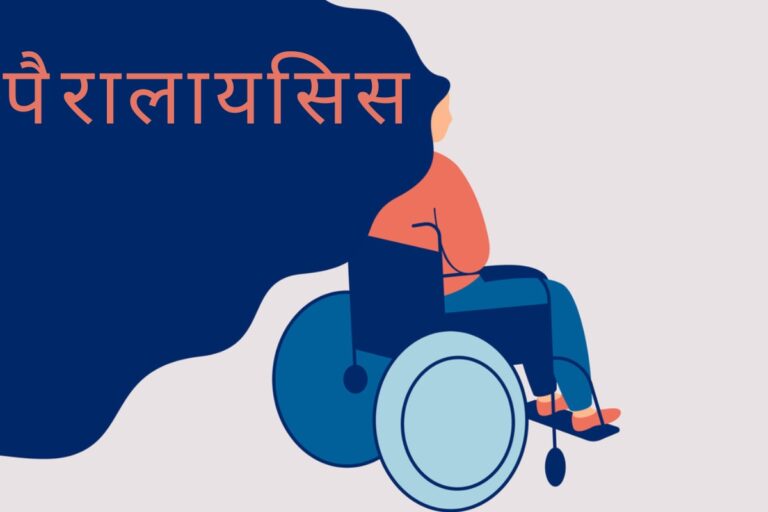 पैरालायसिस (लकवा) होने के लक्षण