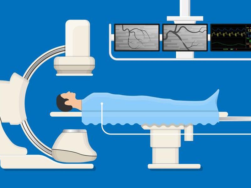 Cost Of Angiography In India
