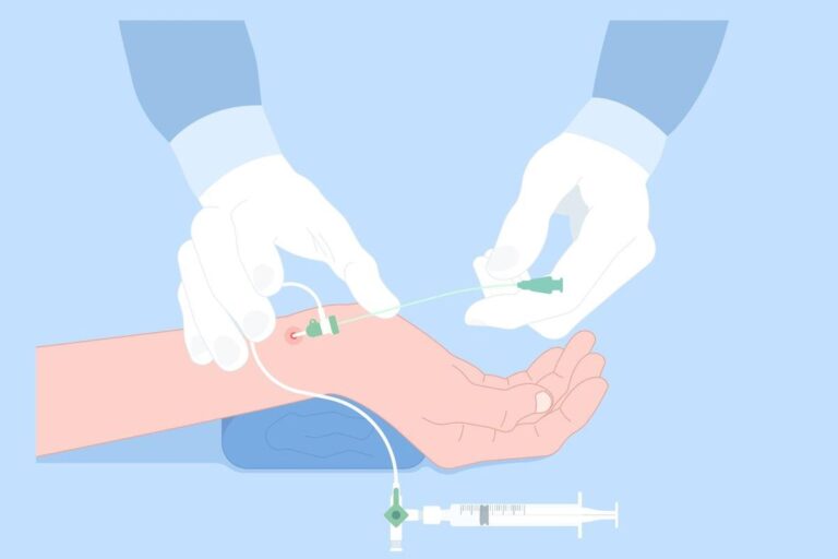 Angiography Cost In India