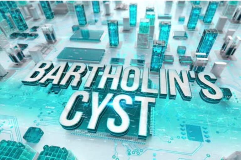 बार्थोलिन सिस्ट के कारण