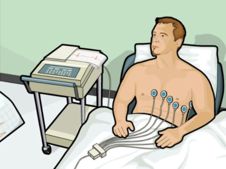 ECG Test Cost In India