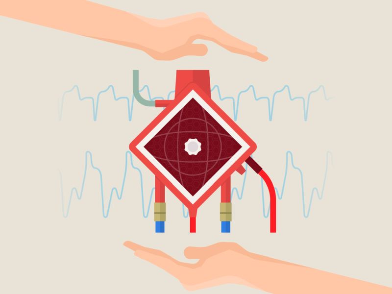 ECMO Treatment Cost Per Day In India