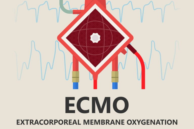 ECMO Treatment Cost In India
