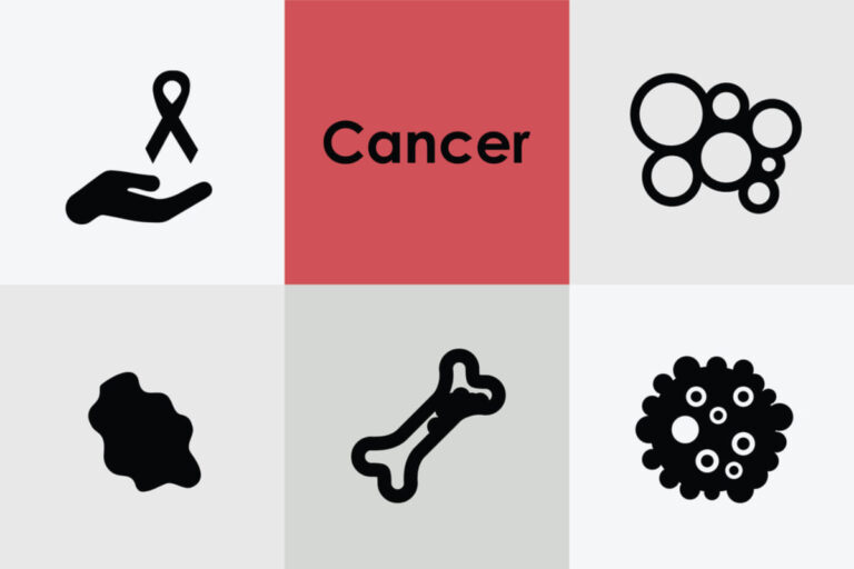 पैरागैंग्लिओमा