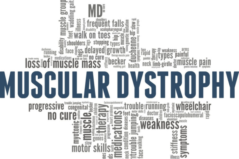मस्कुलर डिस्ट्रॉफी