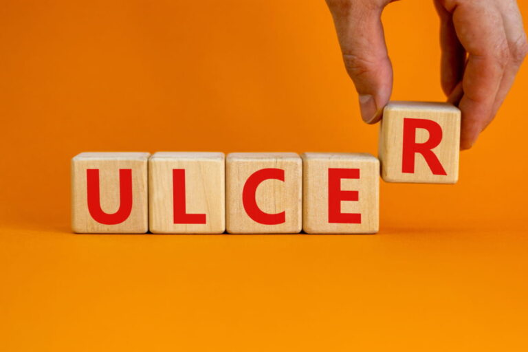 अल्सर के लक्षण