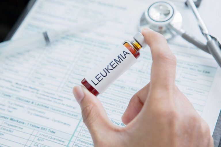 Leukemia Treatment Cost In India