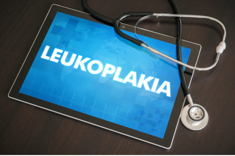 leukoplakia in hindi