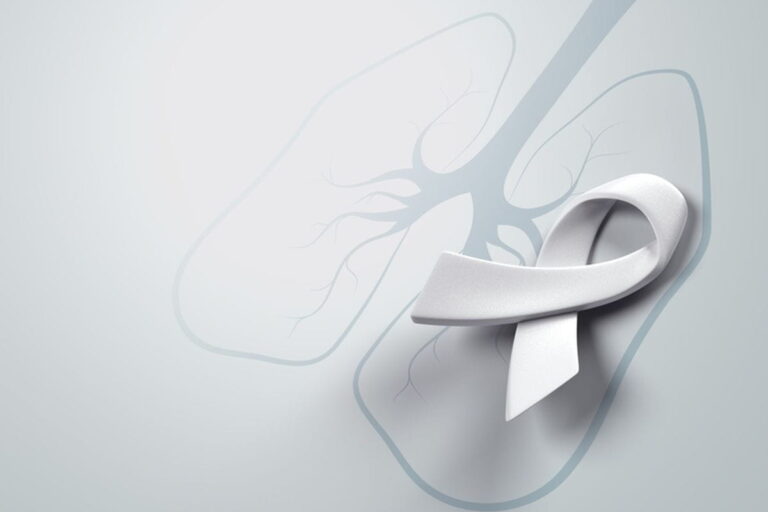 Lung Cancer Treatment Cost In India