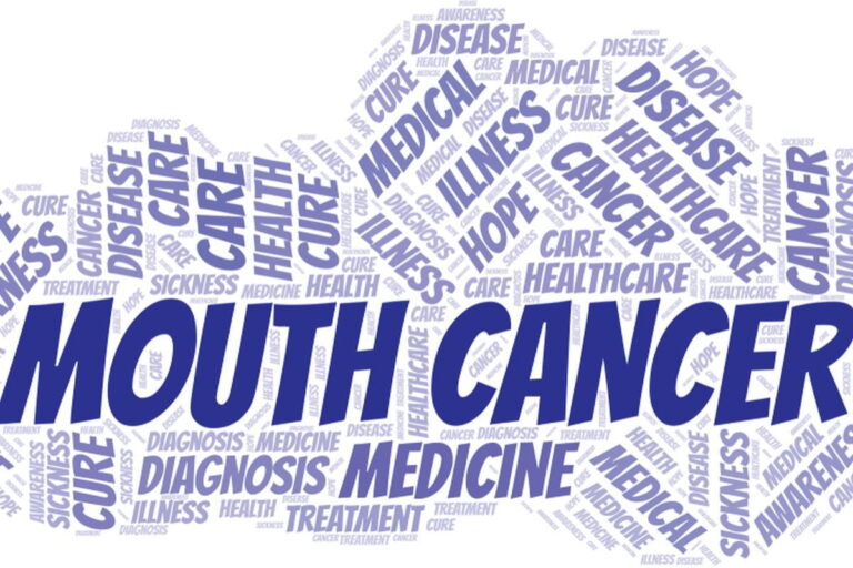 Mouth Cancer Treatment Cost In India