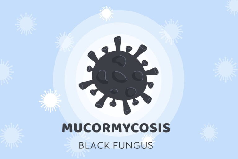 Mucormycosis Treatment Cost In India