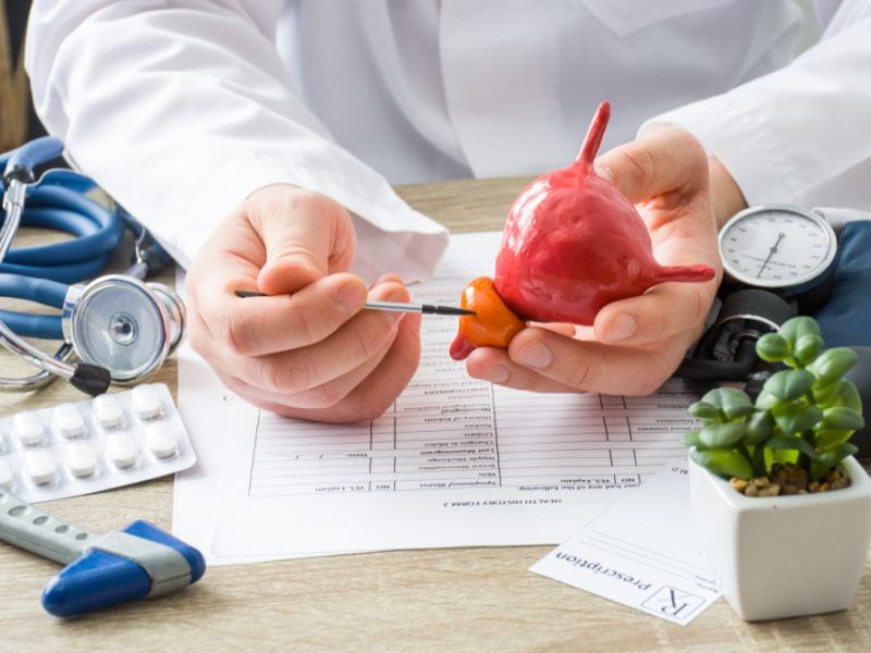 Prostate Cancer Operation Cost In India