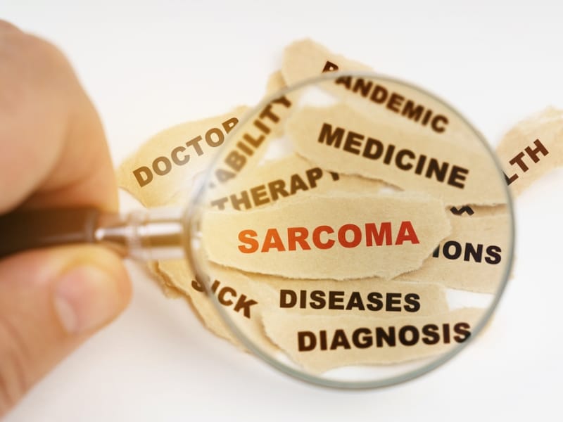 How Fast Does Sarcoma Grow