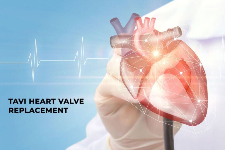 TAVI Procedure Cost In India