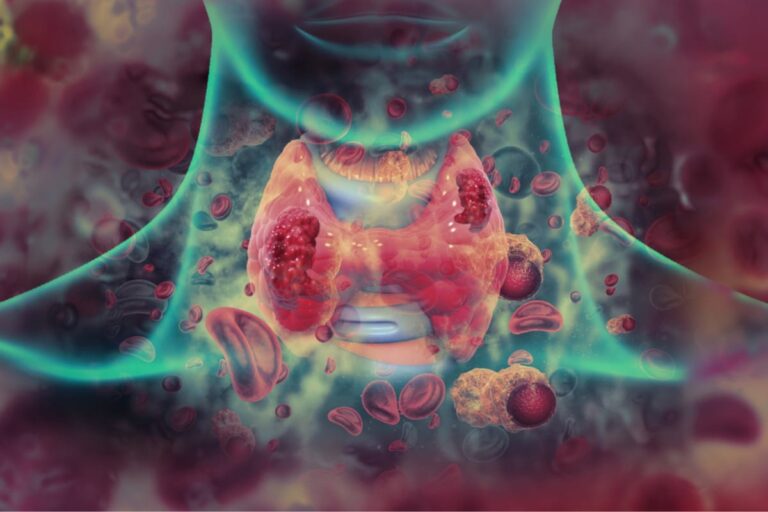 How Long Can You Live With Throat Cancer Without Treatment? - Is Throat Cancer Curable