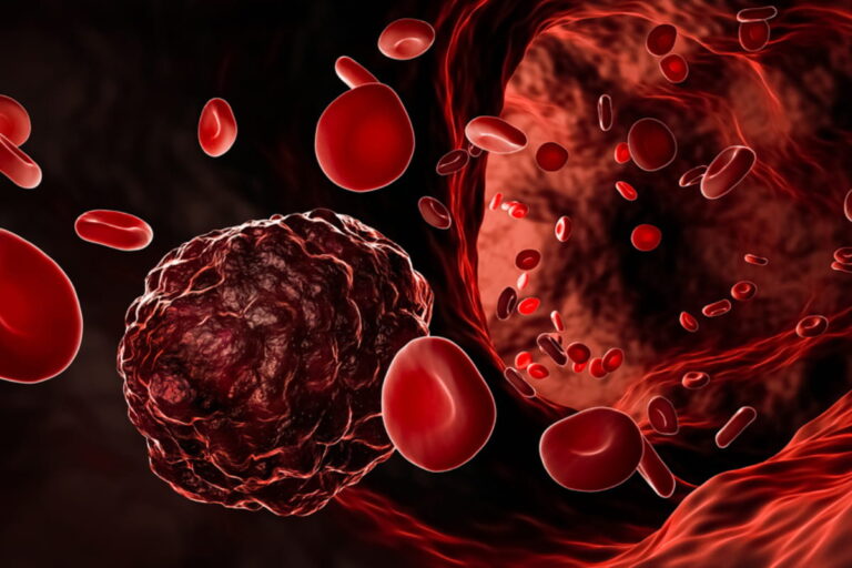 How To Prevent Blood Cancer