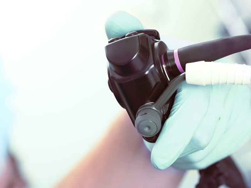 Sigmoidoscopy Test Price