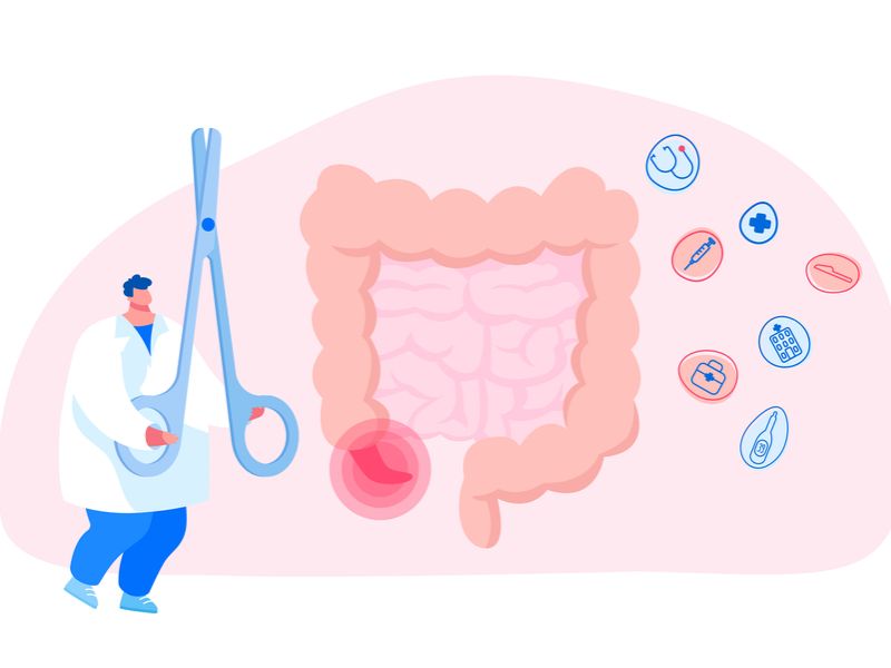 Cost Of Appendix Surgery In India