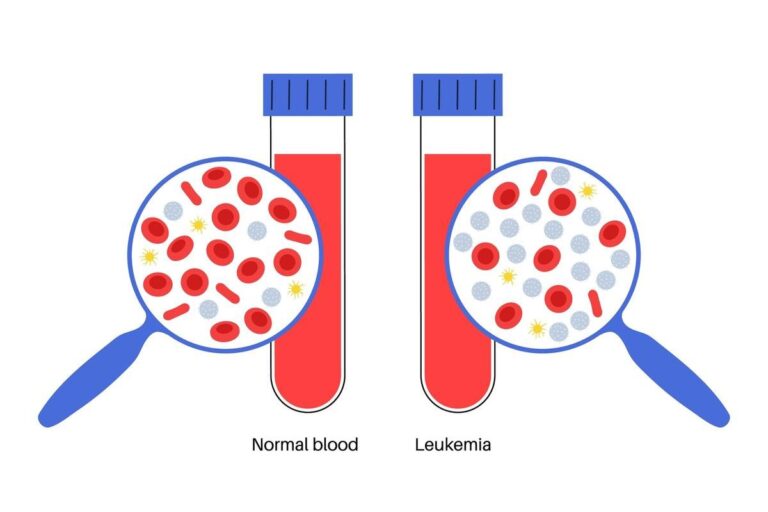 Blood Cancer Treatment Cost In India