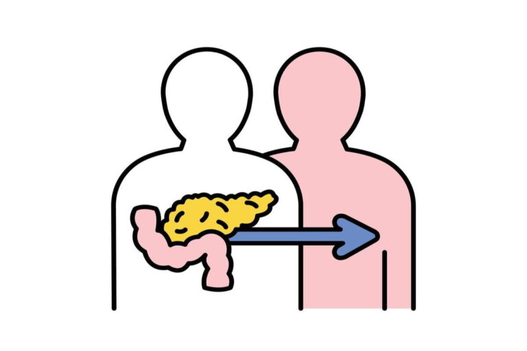 Pancreas Transplant Cost In India