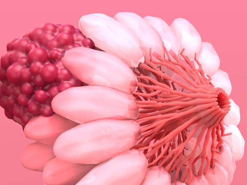 Breast Cancer India