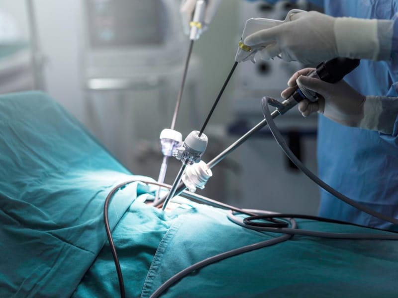 Laparoscopy Surgery Cost