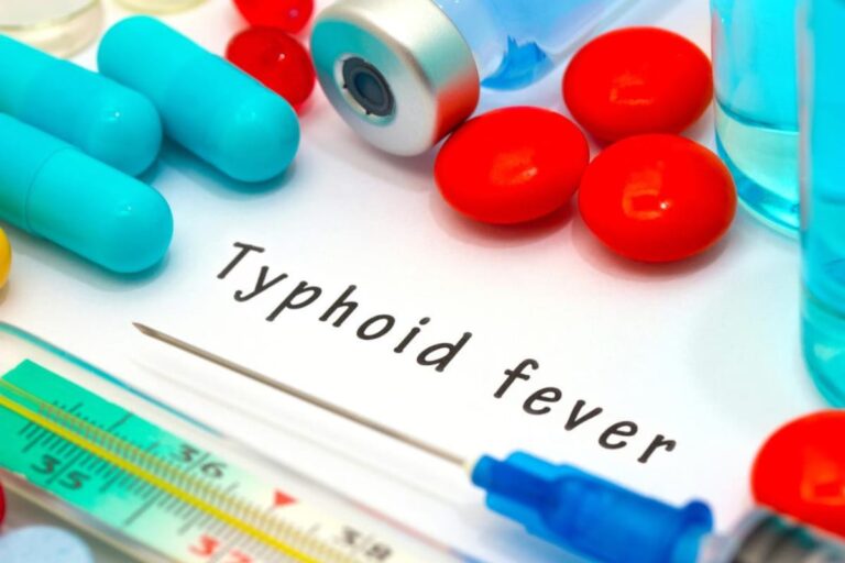 How Long Does Typhoid Fever Last After Treatment