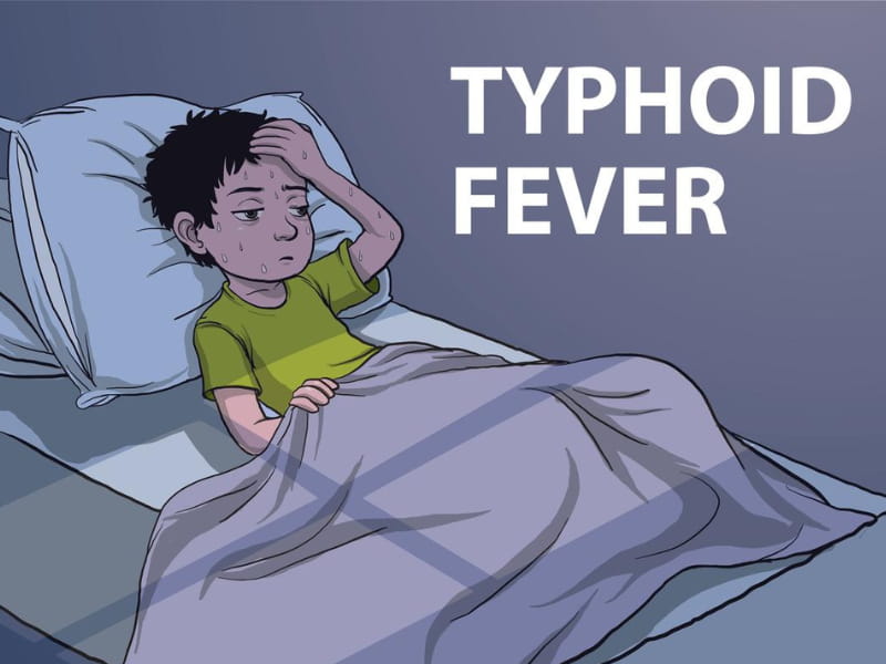 Typhoid Lasts For How Many Days