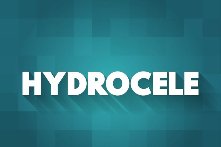 Hydrocele Surgery