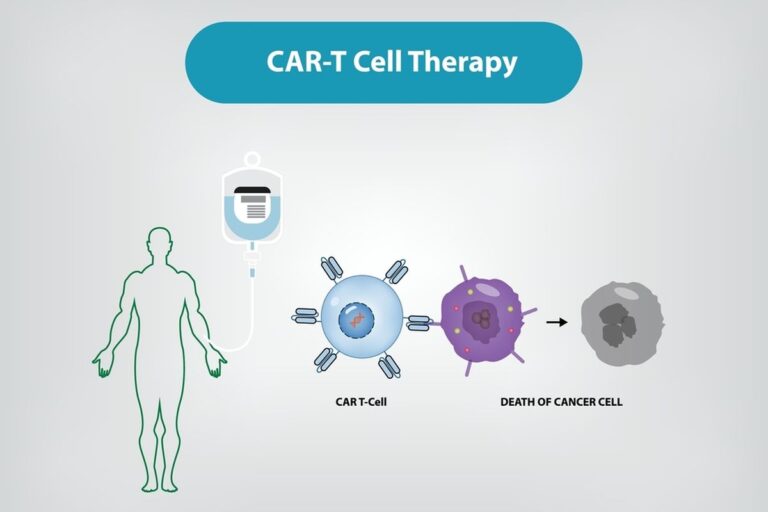 Car T Cell Therapy