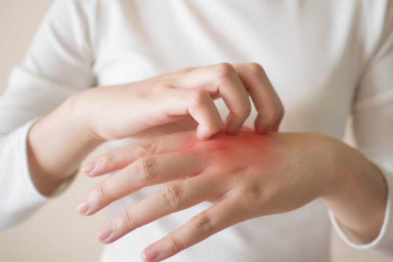 Fungal Infection Treatment