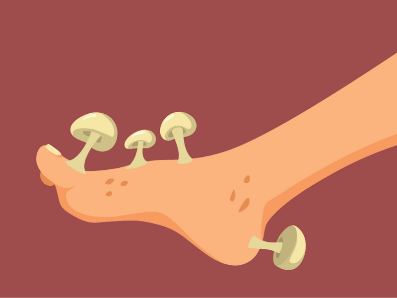 Skin Fungal Infection Treatment