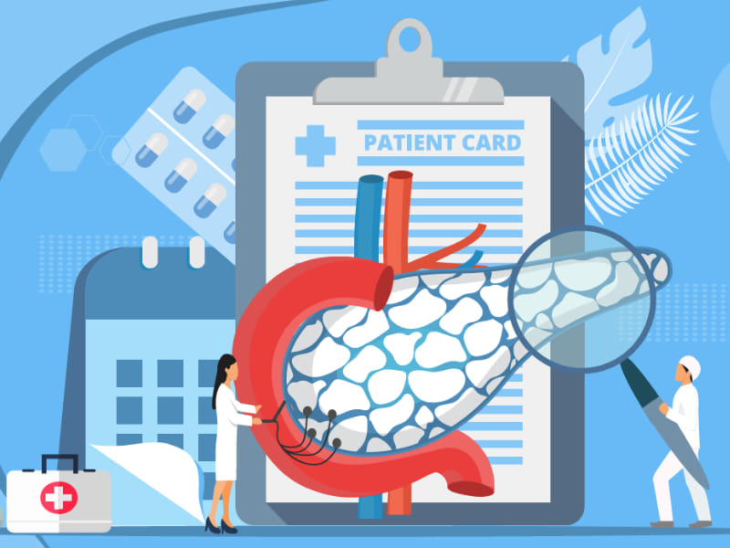 Acute Pancreatitis Treatment