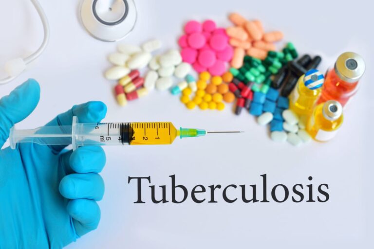 Tuberculosis Treatment