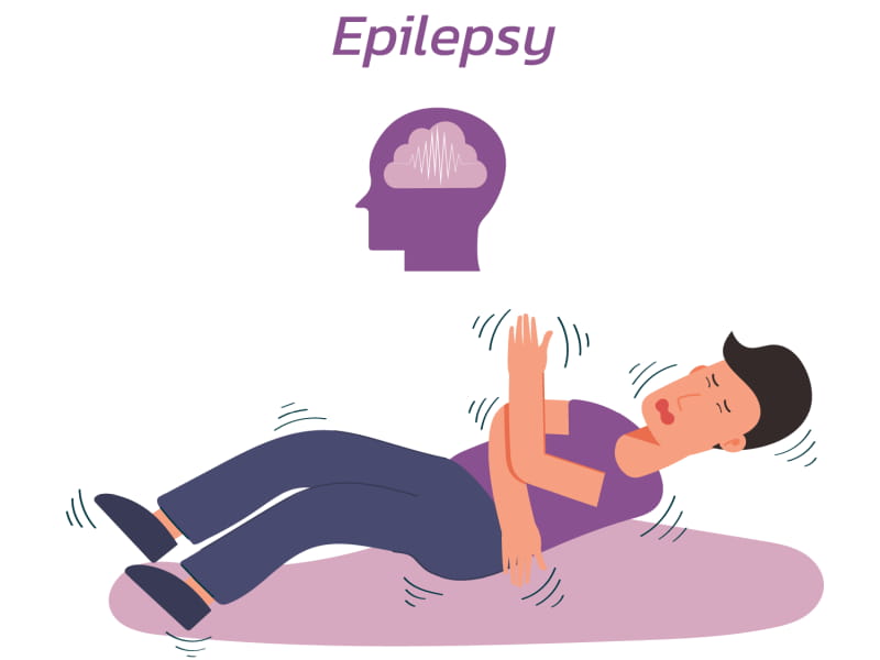 Epilepsy Surgery Cost In India